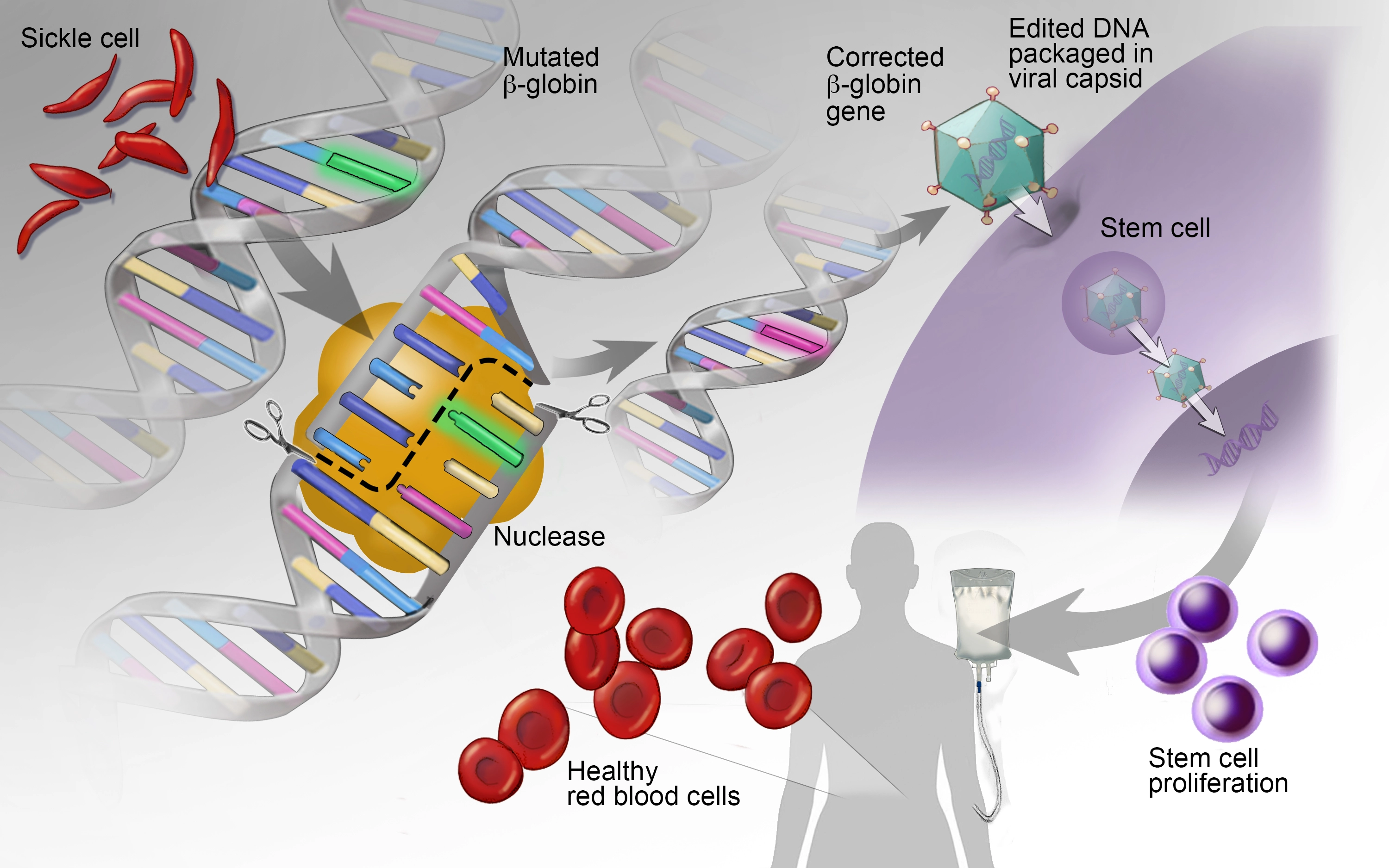 Gene Therapy for Blood Disorders