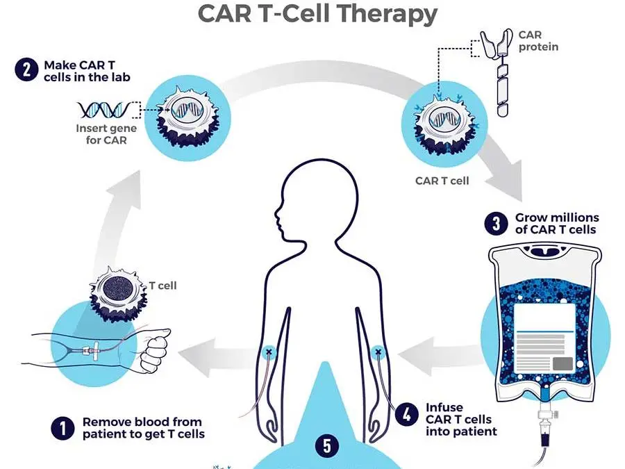 Chimeric Antigen Receptor (CAR) Therapy