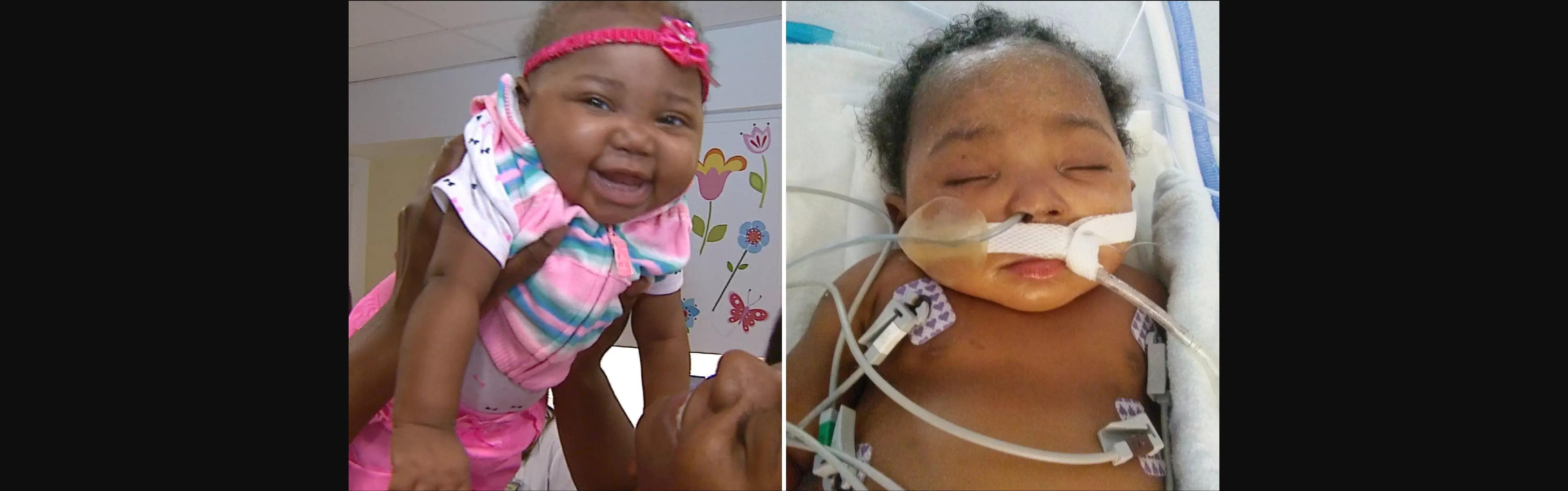 Pediatric Bone Marrow Transplantation